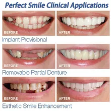 Teeth Whitening Snap On Smile Teeth Cosmetic Denture Instant Perfect Smile Teeth Fake Tooth Cover One Size Fits