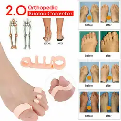 1 пара гель-корректор для пальцев ног 2 шт. пальцы ног сепараторы растягиватели ортопедический молоток Ортопедическая подушка протектор