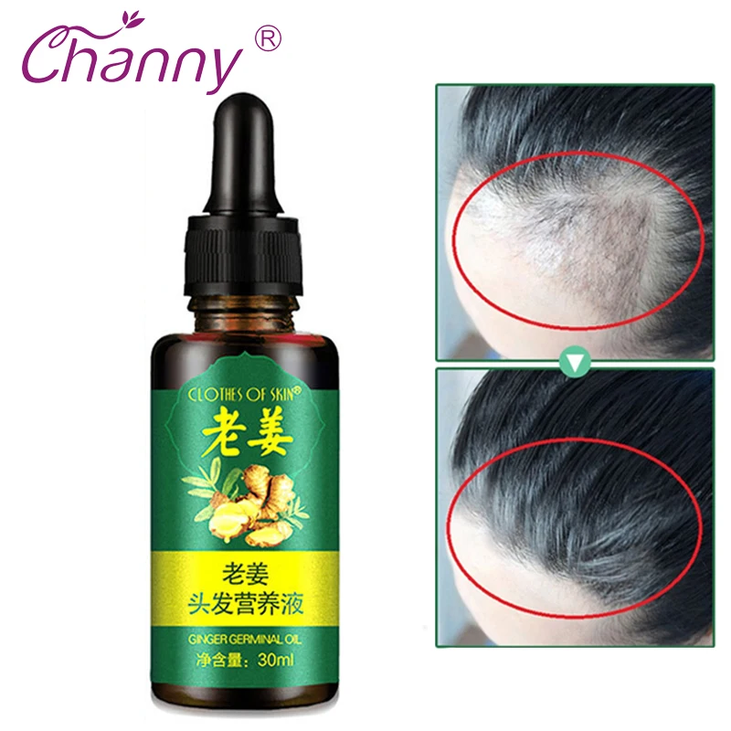 

Channy 7Days Ginger Essence Hairdressing Hairs Mask Hair Essential Oil Hair Care Oil Essential Dry Damaged Hairs Nutrition