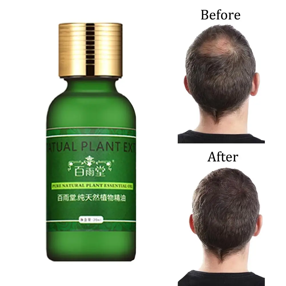 BellyLady 30ml Hair Repair and Nourishing Essence Liquid Anti