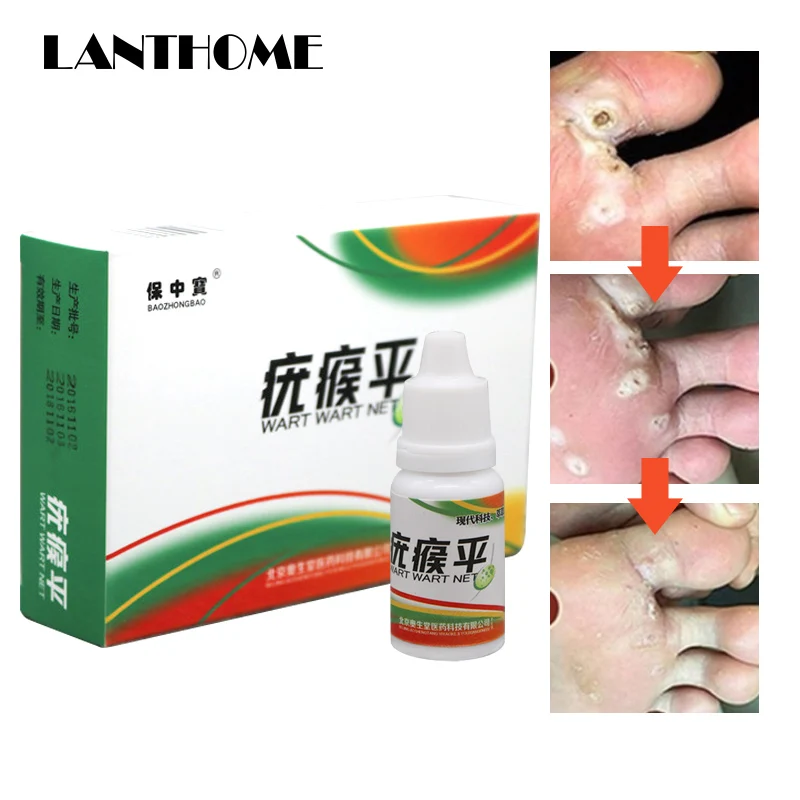 

10ML Skin Tag Remover 12 Hours Tu Kill Medical Tu Kill Mole Wart Remover Treatment Foot Corn Removal Foot Care Medical Liquid
