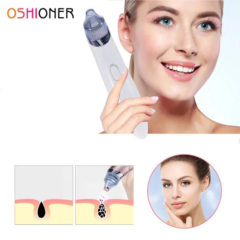 Pore extractor tool stockhoure