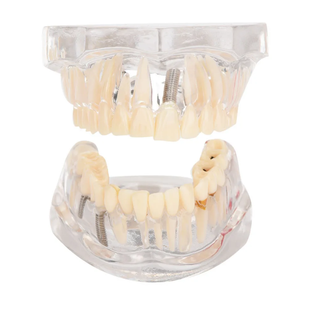 1 шт. Смола Комплексная Стоматологическая практика обучающая модель зубы модели прозрачный нерв съемный молярный зуб для всех возрастов