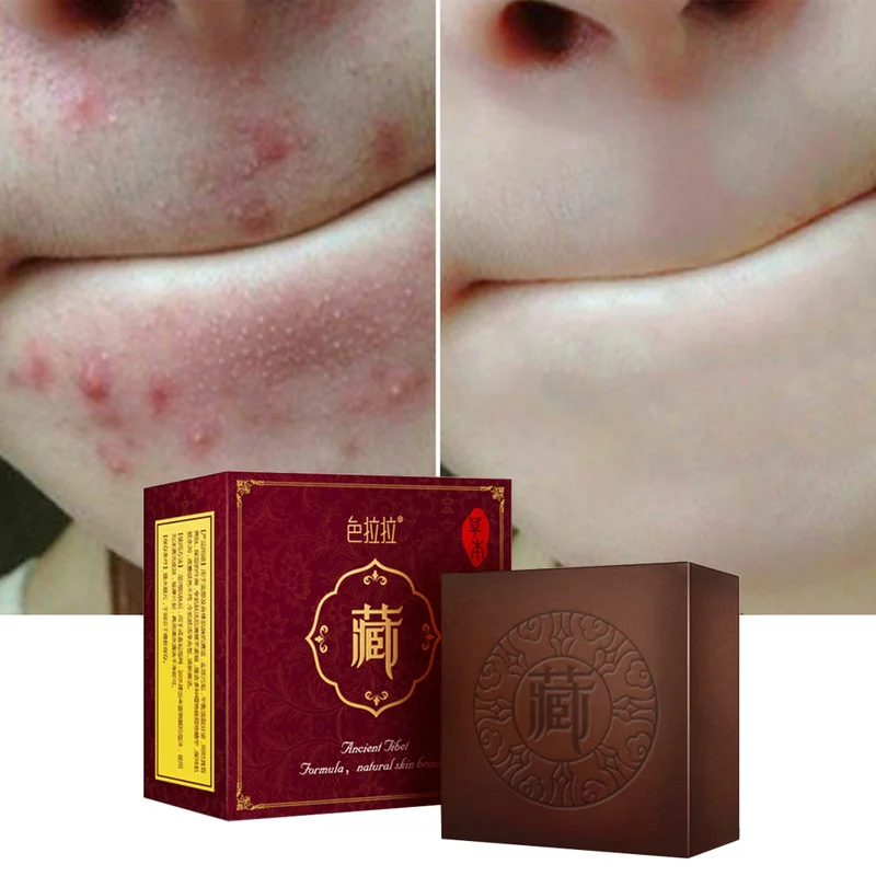 

Oil control soap Removal Blackhead Anti Mites Wash Face Soap Tibetan Medicine Sulphur Ginseng Soap Body Cleansing TSLM1