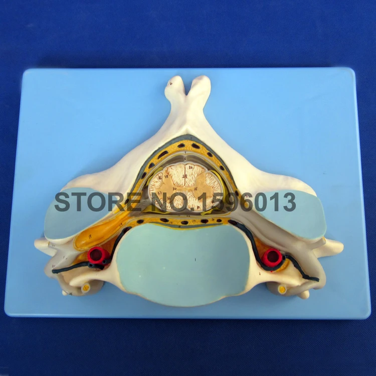 A18104 Vertebra (4)