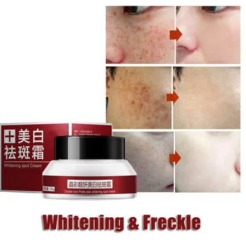 

Herbs Face Cream Skincare Remove Freckles Day Cream Skin Care Bleaching Lightening Remove Facial Moisturizing Whitening Cream