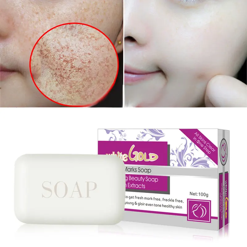 

Pei Mei Face Whitening Facial Soap Whitening Cream Strong Reduces Age Spots anti Freckles Fade Dark Spot treatment freckles