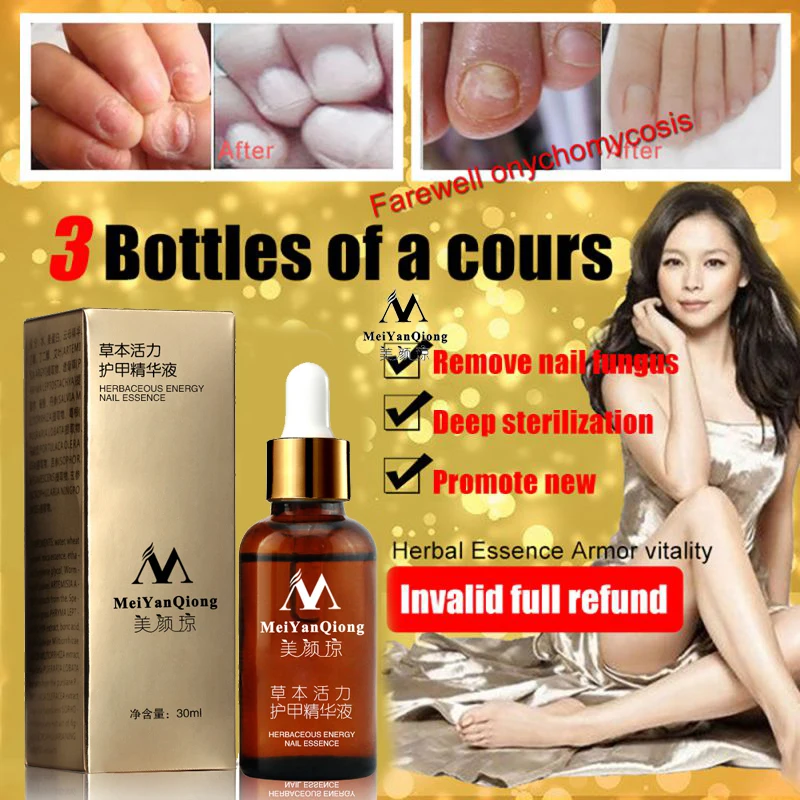 

3pcs New!!! Fungal Nail Treatment Essence Nail And Foot Whitening Toe Nail Fungus Removal Feet Care Nail Gel
