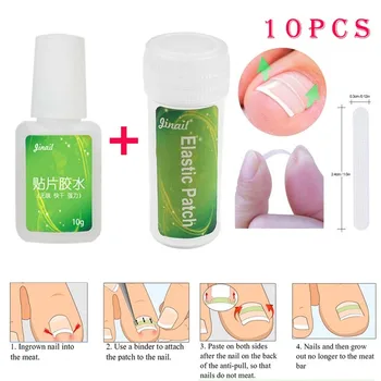 

10PCS/Bottle Ingrown Toenail Correction Tool Set Ingrown Toe Nail Pedicure Elastic Patch Straightening Clip Brace with Glue