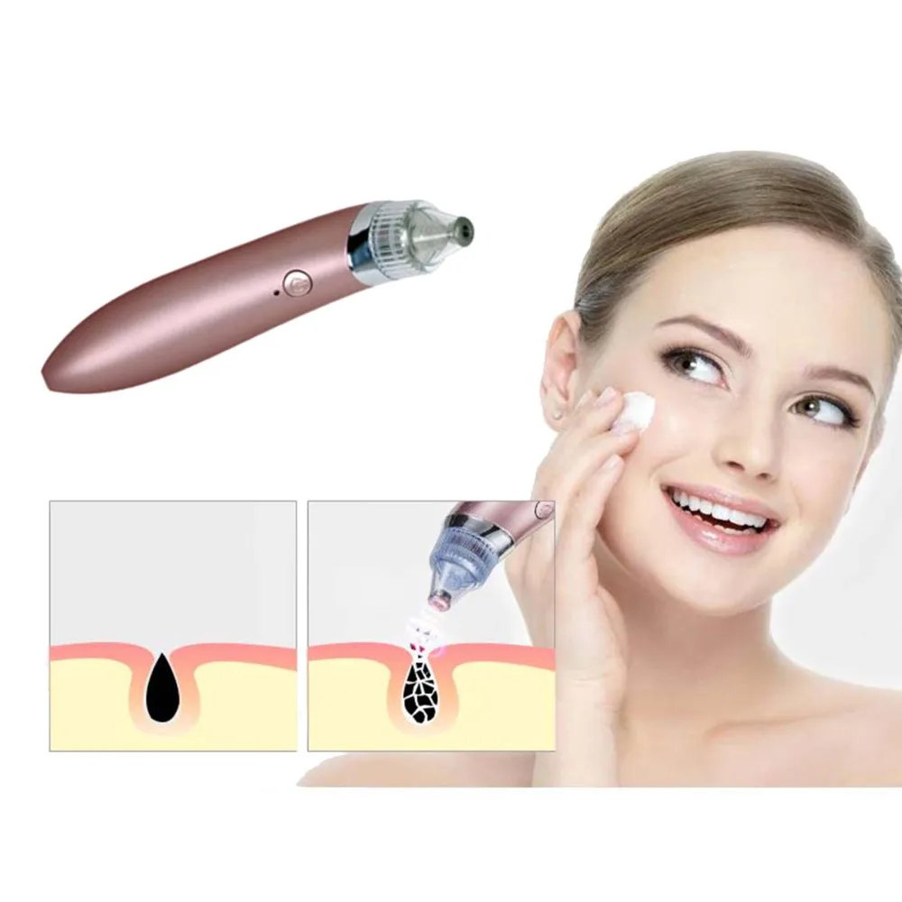 Vacuum Pore Cleaner Blackheads Electric Acne Clean Exfoliating Cleansing face Facial Instrument Comedones Remover Face Skin Care