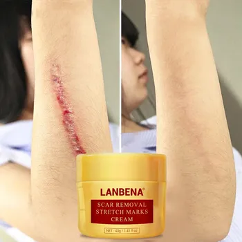 

Herb Scar Removal Cream Face Cream Skin Repair Face Cream Acne Spots Acne Treatment Blackhead Whitening Cream Skin Care CS76