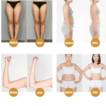 Arm and Leg Weight Loss Slimming Patch