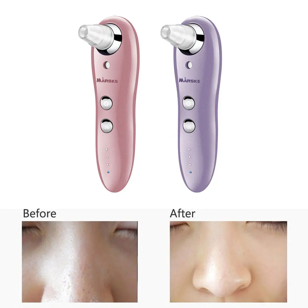 

Vacuum Cleaner Pore Cleanser Blackhead Suction Dirt Suck Up Machine Acne Remover Spray Water Moist Mini Facial 3 Modes Electric