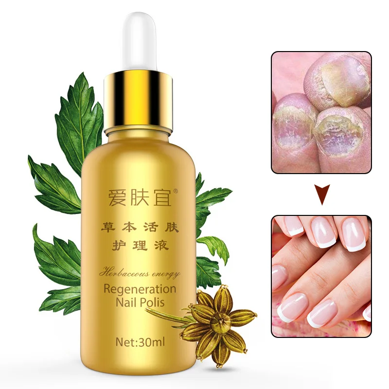 2018 30ml Nail Fungal Treatment Liquid for Toenail Fingernail Anti