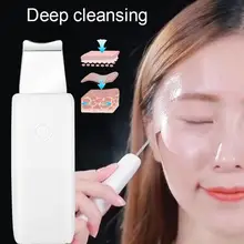 Новая ультразвуковая щетка для кожи лица глубокое очищение шпатель угрей Удаление прыщей очиститель пор для очистки лица