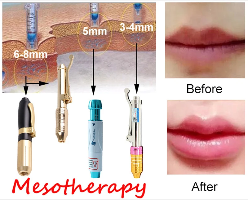 Mesotherapy-800