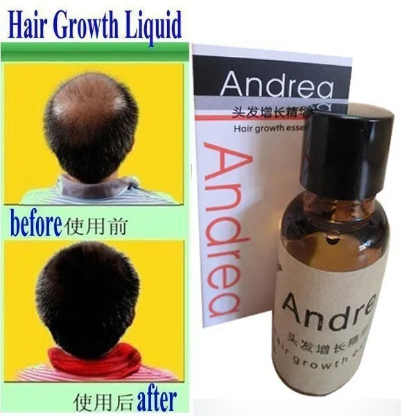 Andrea Hair Growth anti Hair Loss Liquid 20ml dense hair fast sunburst hair growth grow invalid refund alopecia