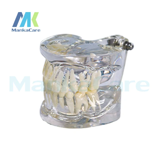 

Manka Care-Clear, первичная модель для ротовой полости, модель зубов