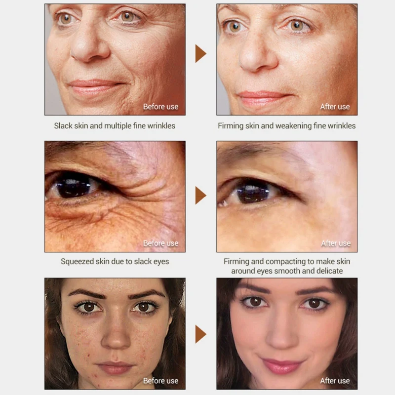 Soro Facial Anti Rugas Anti Envelhecimento Hidratante