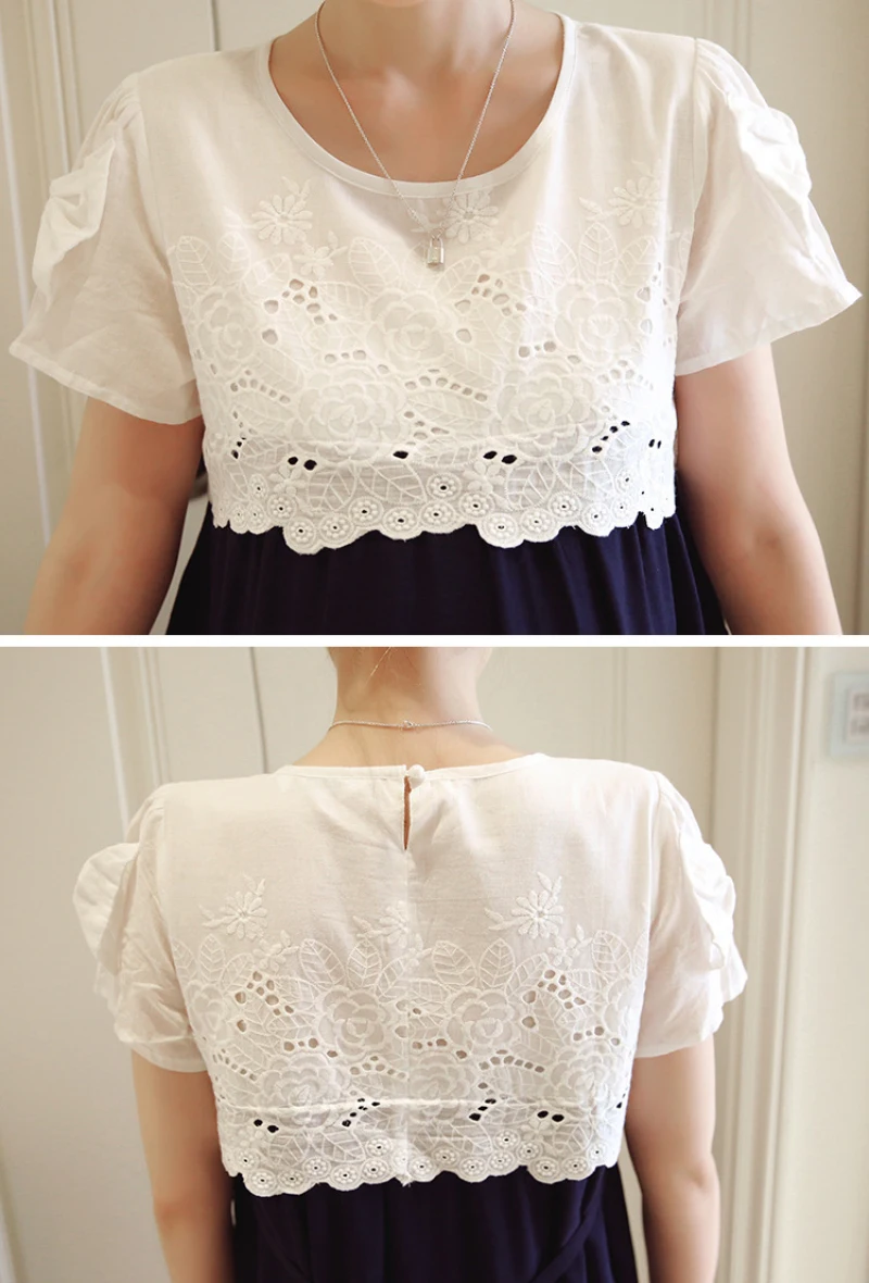 Pregnant Women Lace Splicing Patchwork Dress Summer Pregnancy Clothes for Pregnant Casual Loose Short Sleeve Maternity Dresses (4)