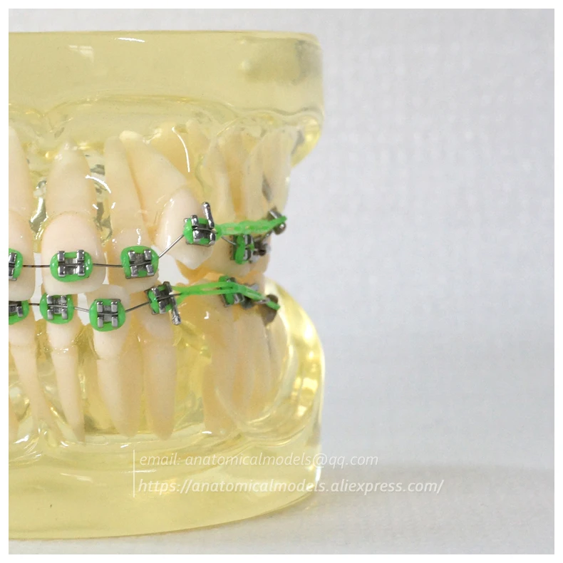 13023 DH202-1 Orthodontic Model 1 