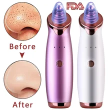 Pro Blackhead Remover Skin Care Pore Vacuum Acne Pimple Removal Vacuum Suction Tool Facial Dermabrasion Face Black Head Clean