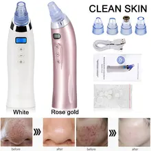 Face Pore Cleaner Blackhead Remover Vacuum Comedo Suction Diamond Dermabrasion Facial Cleaning Beauty Machine Skin Care Face Pore Cleaner Blackhead Remover Vacuum Comedo Suction Diamond Dermabrasion Facial Cleaning Beauty Machine Skin Care