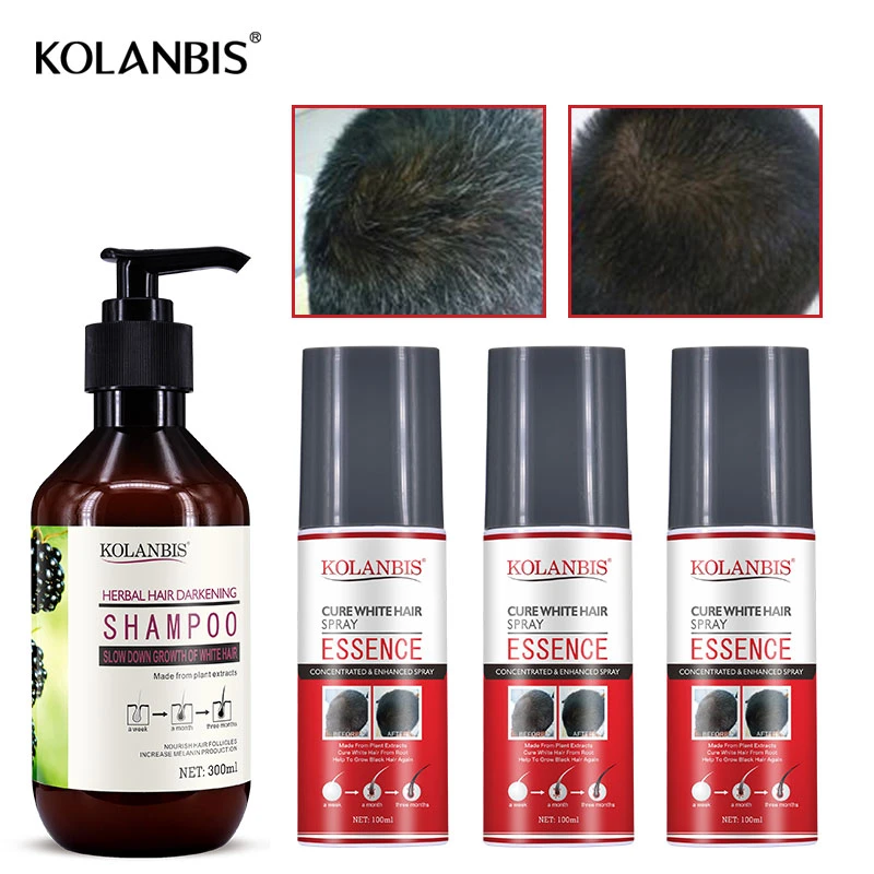 Shampooing Et Gingembre Bio Anti Assombrissement Pour Les Cheveux Gris Et Noirs Ensemble De Spray Pour Les Cheveux Gris Sans Effets Secondaires 4 Pieces Aliexpress
