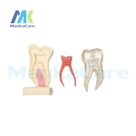

Manka Care - 6Times Anatomic Profile Model of Mandibular Molar/Made from high quality resin,silicone rubber and crystal