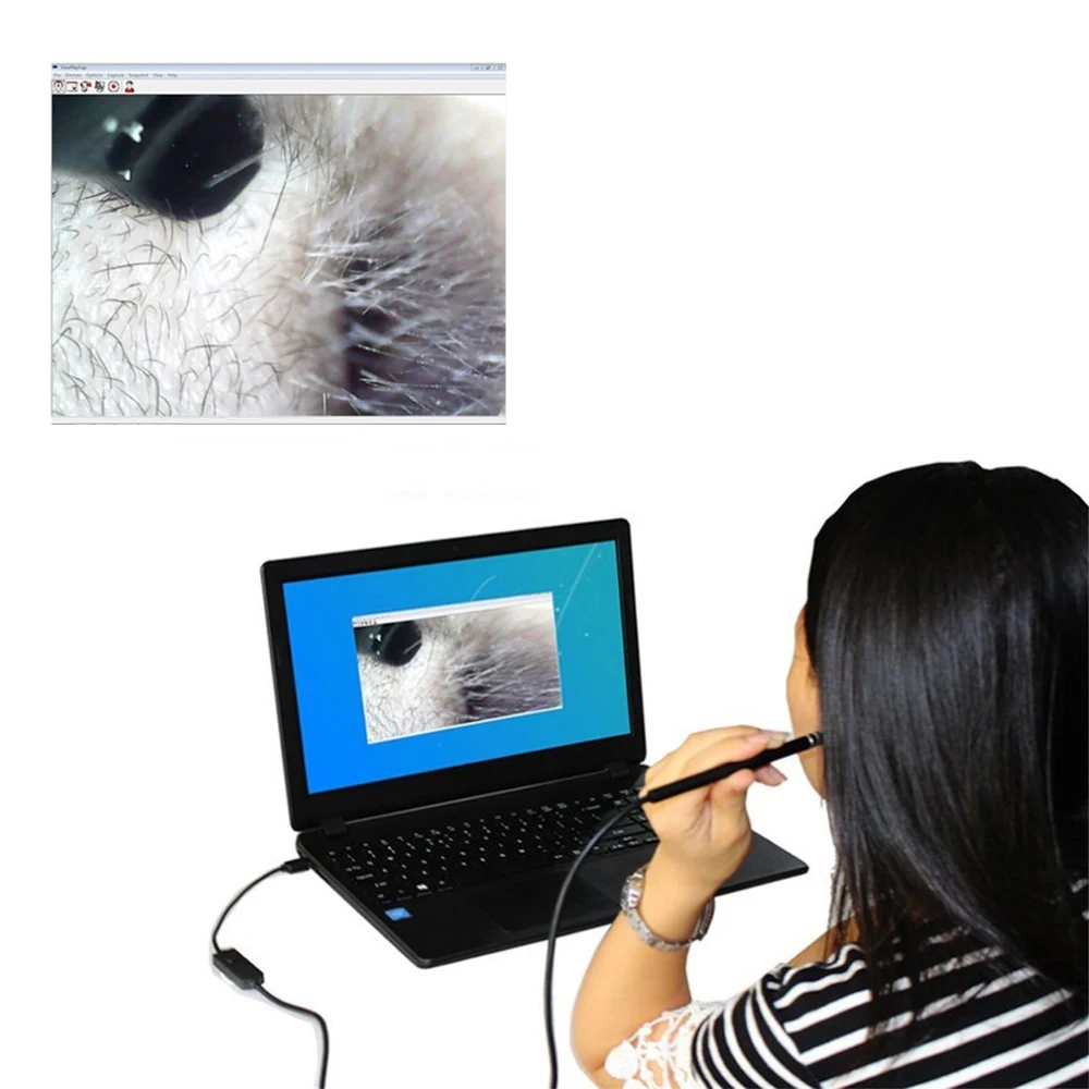 3 в 1 wifi USB эндоскоп Отоскоп камера для телефона Android PC, водонепроницаемый беспроводной визуальный очиститель уха