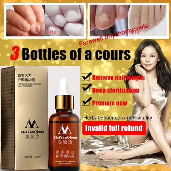 MeiYanQiong Fungal Nail Treatment Feet Care Essence Nail Care Whitening Toe Nail Fungus Removal Gel Onychomycosis nail treatment