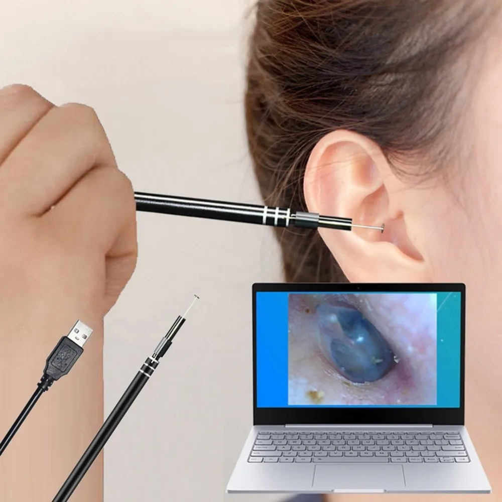 Международная упаковка) USB Ear Cleaning Endoscope HD визуальная ложка многофункциональная с камерой светящаяся Ушная Ухо Уход за ушами