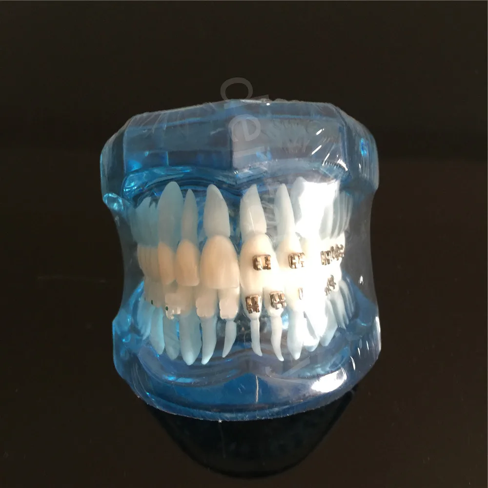 

Teeth Model Blue Dental Orthodontics Communication Model With 4 Types of Brackets