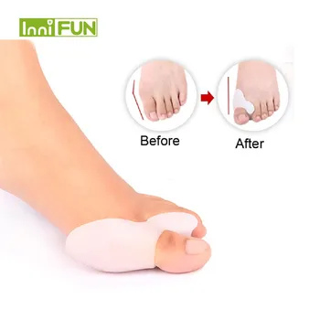 

2pcs Silicone Gel Toe Separators Alignment Bunion Pain Relief Beetle-crusher Bone Ectropion Straightener Foot Care Tool