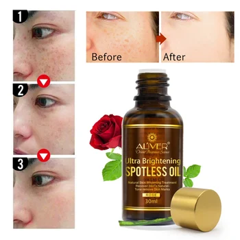 

30Ml Rose Essential Oils Splash Freckle Remove Anti Wrinkles Essence Oil Dark Blots Disappear Cleansing Face Serum Body Care
