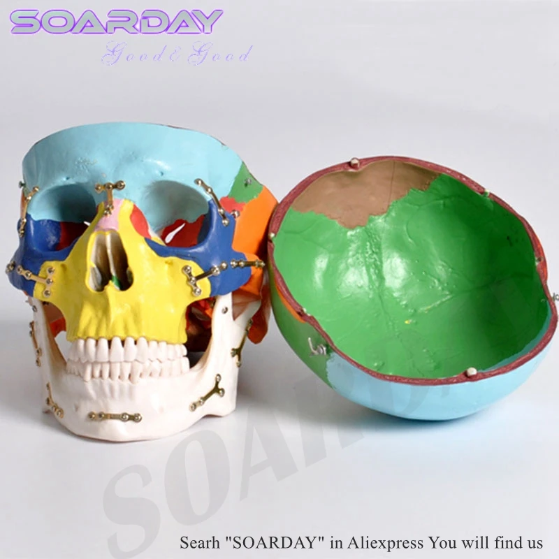 SOARDAY модель черепа с клолоурными переломами фиксированная Больничная клиника