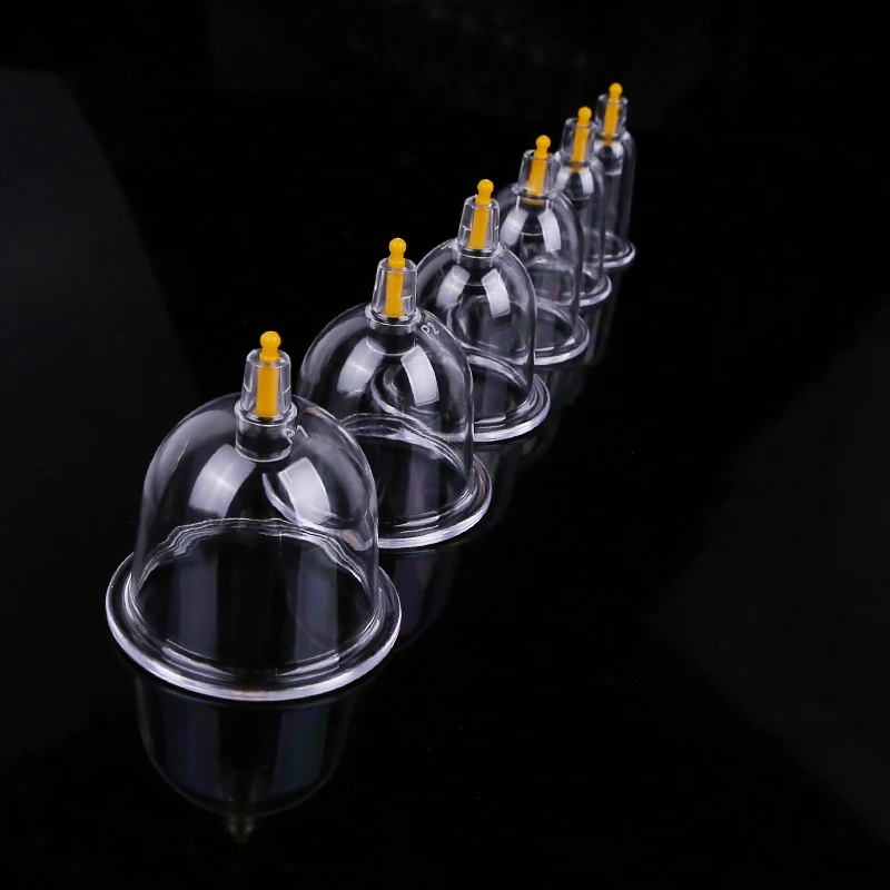 cupping (3)