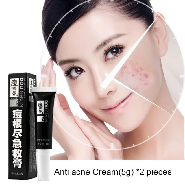 zits skin treatment Cream capillary Acne Anti skincare patch rosacea acne