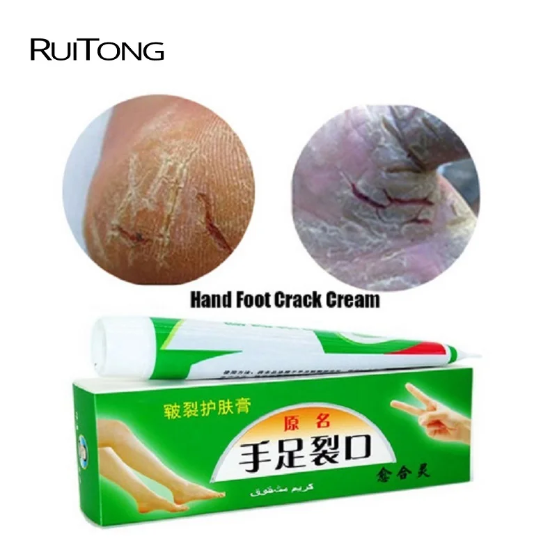 

RUITONG 2Pcs Powerful Hand Foot Crack Cream Hand And Foot Heel Anti Crack Cream Anti Dry Crack Chinese Medicinal Ointment Cream