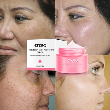 

efero Whitening Freckle Cream 30g Remove Acne Spots Melanin Whitening Moisturizing Anti-wrinkle Face Care Cream Skin Care