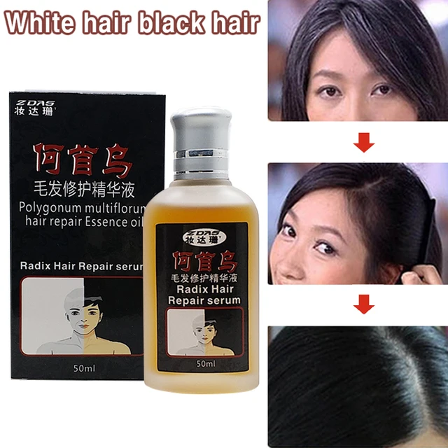 Medicine For White Hair To Turn Black News And Health