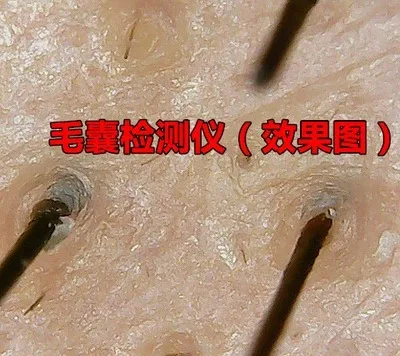 TB22_97lrFkpuFjy1XcXXclapXa_!!692559493.jpg_400x400.jpg_.webp