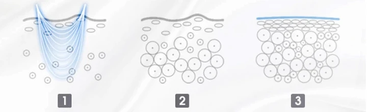 RF-Technology