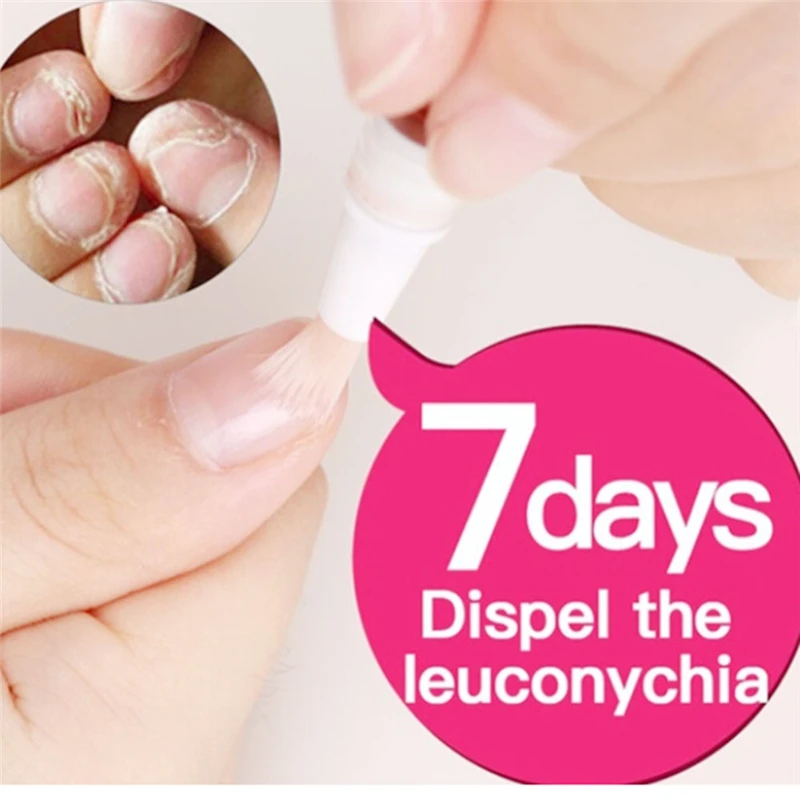 3 мл для ремонта ногтей противогрибковые ручки для ногтей Onychomycosis Paronychia инфекция травяной носок палец ногтей Здоровое питание