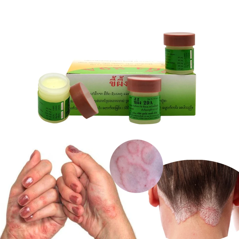 1pc tailândia 29a pomada natural psorisi eczma creme funciona muito bem para dermatite psoríase eczema urticária beriberi