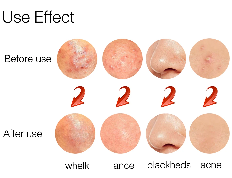 use-effect