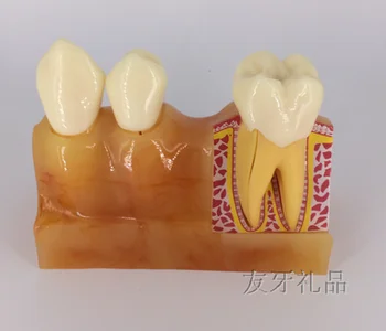 

4X teeth anatomical model Teaching to explain pulp and anatomical dental model free shipping