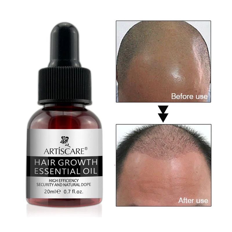 

Fast Growth Serum Sunburst Hair Growth oil Anti Baldness Hair Care Hair Loss Treatment Beard Oil Growing Facial Hairs Serum