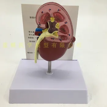 

kidney anatomical model diseased kidney internal organs anatomical model