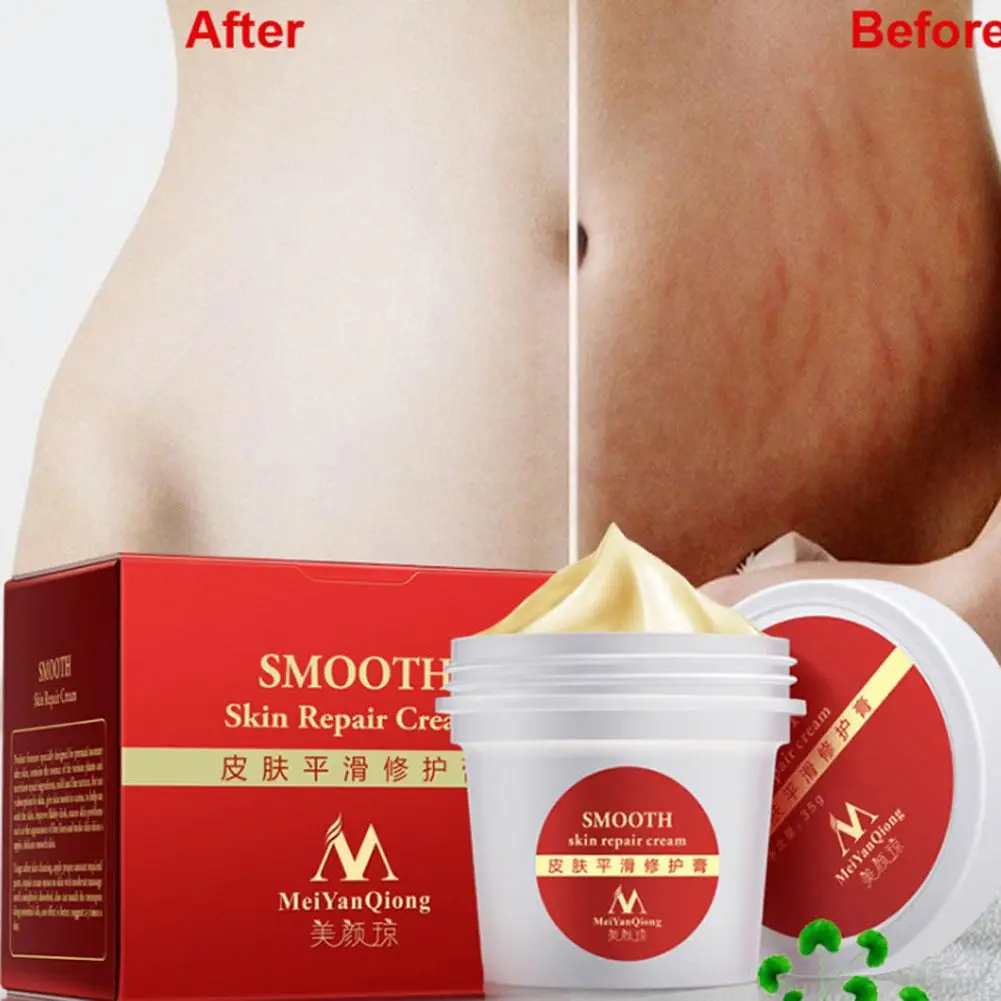 

Maternity Skin Repair Body Cream for Stretch Marks Scar Removal Remove Scar Care Postpartum Pregnancy Serum Smooth Skin Creams